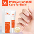 MeiYanQiong Herbal Nail Treatment Onychomycosis Paronychia Anti Fungal Nail Infection Good Result Chinese Herbal Toe Nail Fungus Treatment. 