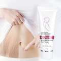 Stretch Marks Scar Removal Maternity Skin Body Repair Cream. 