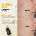 Malika 30X Vitamin C Serum - Serum - Vitamin C Serum - Serum For ( Skin Glow, Anti Aging And Enhance Skin Texture ) - Serum For Glowing Skin - Vitamin C Serum For Face - Skin Brightening Serum - Skincare - Body Serum - Kass Cosmetics. 
