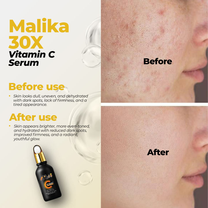 Malika%2030X%20Vitamin%20C%20Serum%20-%20Serum%20-%20Vitamin%20C%20Serum%20-%20Serum%20For%20(%20Skin%20Glow,%20Anti%20Aging%20And%20Enhance%20Skin%20Texture%20)%20-%20Serum%20For%20Glowing%20Skin%20-%20Vitamin%20C%20Serum%20For%20Face%20-%20Skin%20Brightening%20Serum%20-%20Skincare%20-%20Body%20Serum%20-%20Kass%20Cosmetics%20-%20Image%203