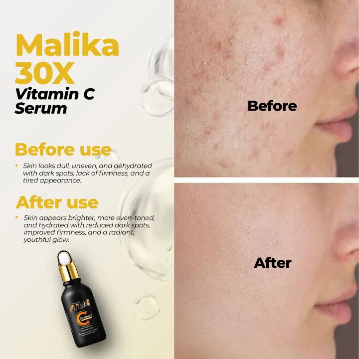 Malika%2030X%20Vitamin%20C%20Serum%20-%20Serum%20-%20Vitamin%20C%20Serum%20-%20Serum%20For%20(%20Skin%20Glow,%20Anti%20Aging%20And%20Enhance%20Skin%20Texture%20)%20-%20Serum%20For%20Glowing%20Skin%20-%20Vitamin%20C%20Serum%20For%20Face%20-%20Skin%20Brightening%20Serum%20-%20Skincare%20-%20Body%20Serum%20-%20Kass%20Cosmetics%20-%20Image%203