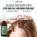 Kilarca DHT Blocker & Biotin Hair Growth Spray - Premium Hair Tonic for Hair Care & Growth - For Women & Men, All Hair Types. 