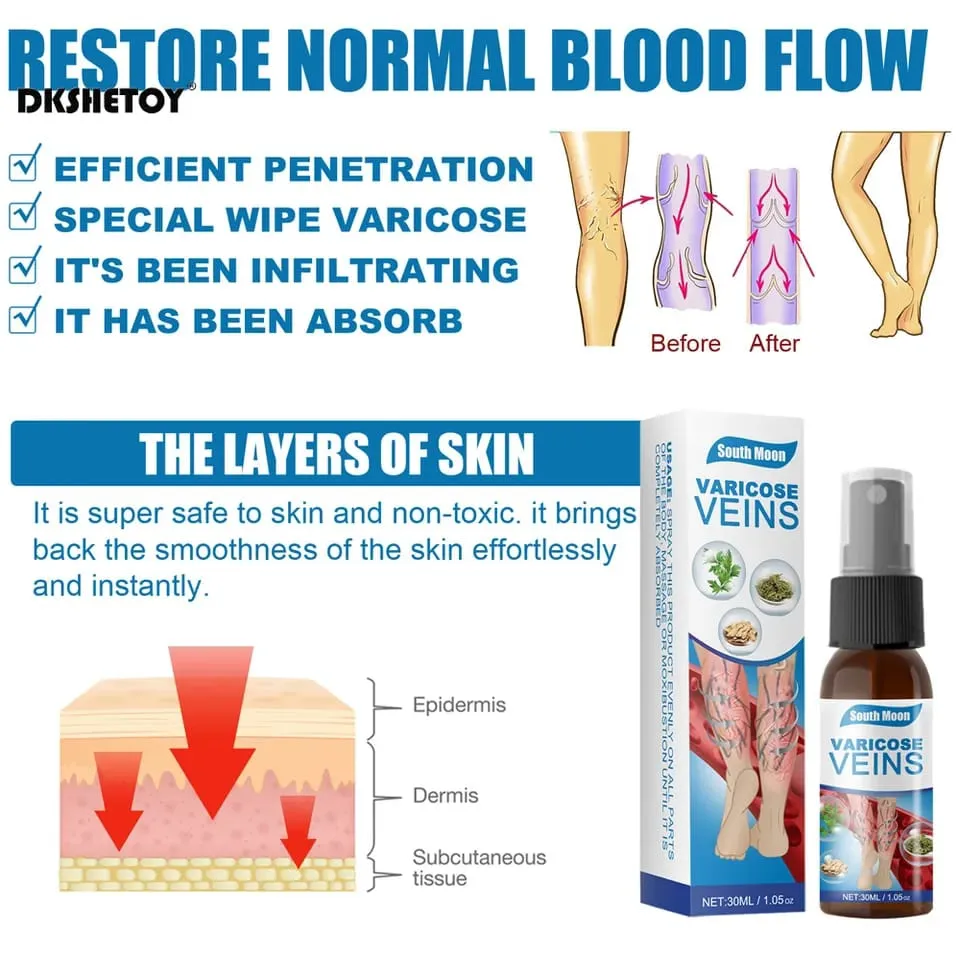 Varicose Vein Relief Spray, 30ml - Herbal Treatment for Blood Vessel  Smoothness & Circulation Enhancement | Daraz.pk