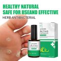 New 10ml Foot Corn Eence Effective Feet Callue Wart Remover Foot Wart Cream - 287991028. 