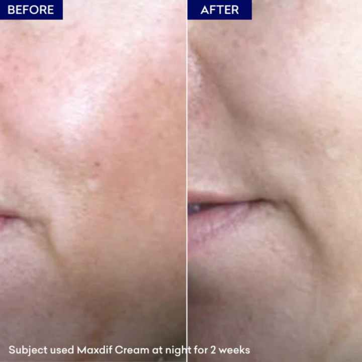 Jenpharm%20-%20Maxdif%20Skin%20Brightening%20Cream%20With%20Vitamin%20C%20&%20Niacinamide%20-%2040gm%20%7C%20For%20Dark%20Spots,%20Hyperpigmentation%20&%20Even%20Tone%20%7C%20No.#1%20Best%20Selling%20Face%20Cream%20in%20Pakistan%20-%20Image%208