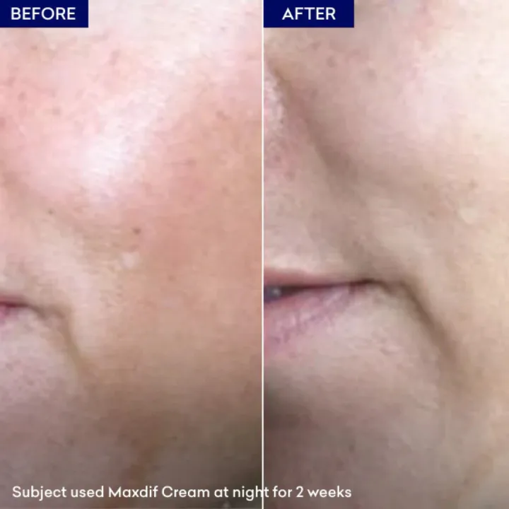 Jenpharm%20-%20Maxdif%20Skin%20Brightening%20Cream%20With%20Vitamin%20C%20&%20Niacinamide%20-%2040gm%20%7C%20For%20Dark%20Spots,%20Hyperpigmentation%20&%20Even%20Tone%20%7C%20No.#1%20Best%20Selling%20Face%20Cream%20in%20Pakistan%20-%20Image%208