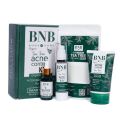 BNB Acne Control Kit (4 in 1). 