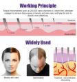 Derma Roller 0.5 Mm for Hair & Skin use. 