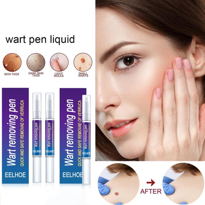 Warts Removal Pen Eliminate Wart Pen Wart Liquid Hand Foot Warts Remove Filiform Warts Flat Warts Condyloma Acuminatum