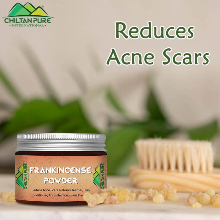 Frankincense%20Powder%20%5B%D9%84%D9%88%DB%81%D8%A7%D9%86%5D%20-%20Image%202