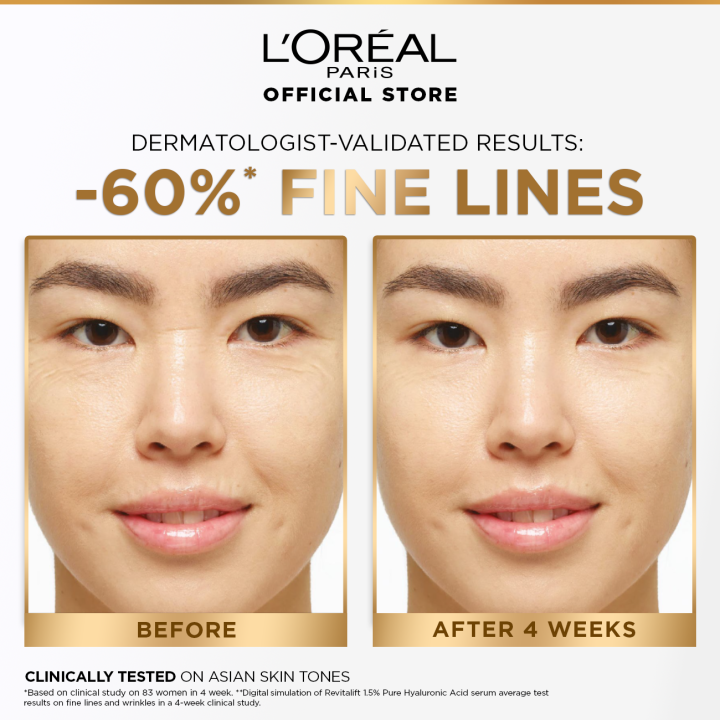 L'Oreal%20Paris%20Innovation%20Revitalift%20Hyaluronic%20Acid%201.5%25%20Hyaluron%20Serum,%2015ml%20-%20Hydrating,%20Anti-Aging,%20Glass%20Skin%20-%20Image%204