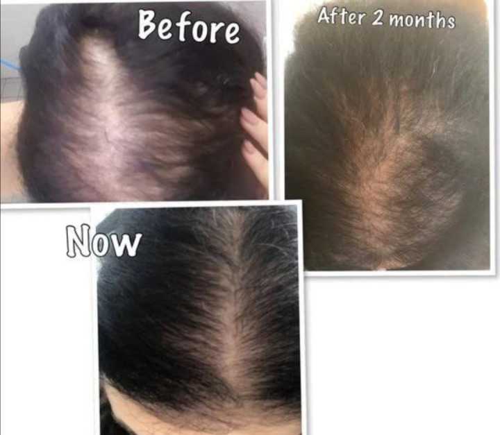 BioSeven%20Pro%20%20Herbal%20Shampoo%20and%20Kaseer%20amla%20Oil%20-%20Image%202