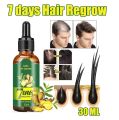 7 Days Hair Growth Germinal Serum Oil Natural Hair Treatment Effective Fast Growth Hair Care 30ML. 
