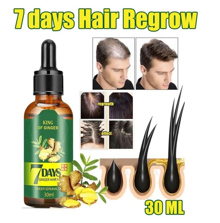 7%20Days%20Hair%20Growth%20Germinal%20Serum%20Oil%20Natural%20Hair%20Treatment%20Effective%20Fast%20Growth%20Hair%20Care%2030ML%20-%20Image%203