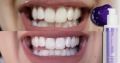 Hismile V34 Purple Color Corrector Teeth. 