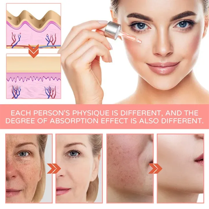 FORT%205IN1%20Whitening%20Serum%20for%20Face%20-%20Anti-Aging,%20Dark%20Spot%20Correcting,%20and%20Whitening%20Serum%20for%20Glowing%20Skin%20%7C%20Glass%20Skin%20Care%20Products%2030ML%20-%20Image%202