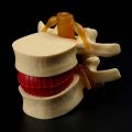 Lumbar Vertebrae Model Anatomical Spine Lumbar Disc Herniation Anatomy Teaching Tool Lumbar Vertebrae Model. 