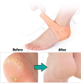 Silicone Heel Pads Anti Crack Heel Protector Silicone Gel Heel Pads for Pain Relief Soft Heel Cups Elastic Durable Heel Guard for Men and Women 1 Pair. 