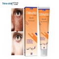 Clobewhite Cream for Freckles and Pigmentation Removal - Achieve Balanced Skin Tone. 