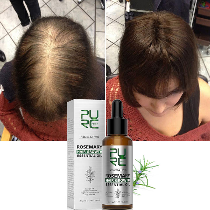 PURC Rosemary Oil Hair Growth Products for Man Women Ginger Anti Hair Loss Fast Regrowth Thicken Oils Scalp Treatment Hair Care BruberryBeD