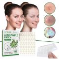 Amnnnesia For JAYSUING Acne Pimple Patch Acne Treatment Stickers Pimple Remover Tool Blemish Spot Skin Care Face Mask Acne Cream Night Use. 