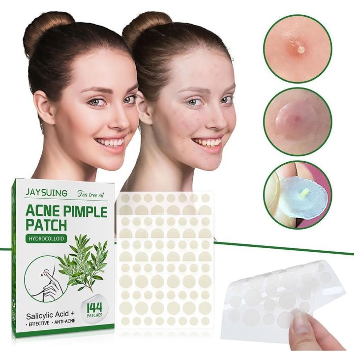 Amnnnesia For JAYSUING Acne Pimple Patch Acne Treatment Stickers Pimple Remover Tool Blemish Spot Skin Care Face Mask Acne Cream Night Use