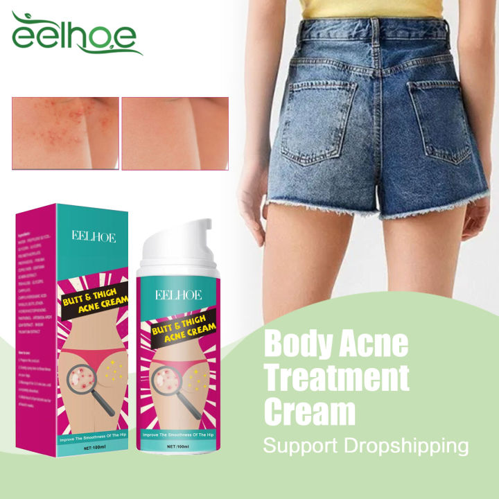 Hip Acne Treatment Cream Butt Inner Thigh Pimples Clearing Remove Dark Spot Prevent Buttock Pores Clogging Body Acne Repair Care