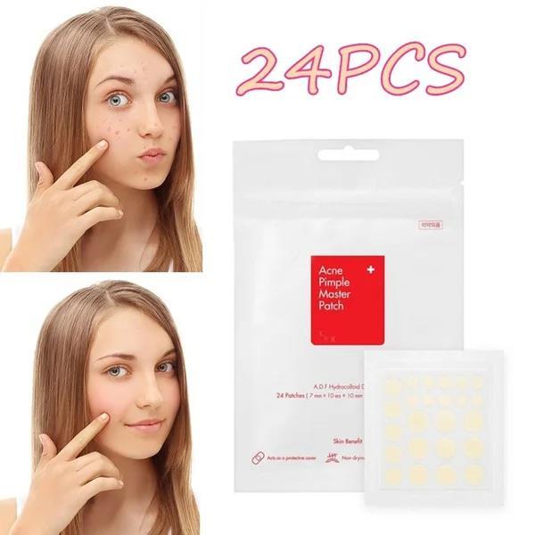 24pcs%20Face%20Acne%20Pimple%20Spot%20Facial%20Skin%20Care%20Blackhead%20Removal%20Freckle%20Patches%20Scar%20Care%20Treatment%20Stickers%20Acne%20Mask%20Beauty%20-%20Image%207