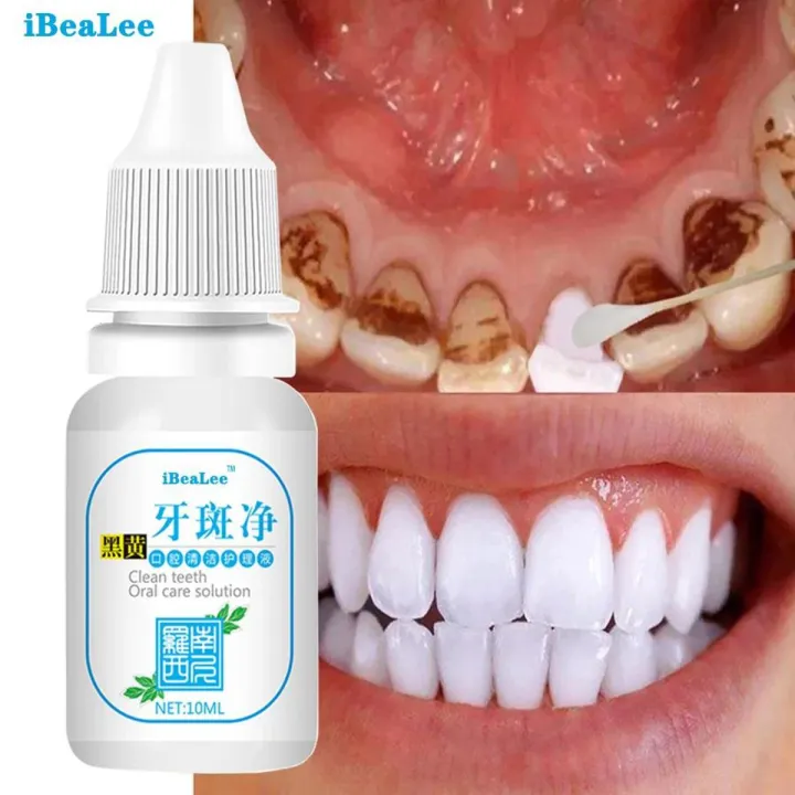 Mozilend%20-%20Teeth%20Whitening%20Powder%20-%20Natural%20Teeth%20Whitening,%20Teeth%20Polish%20&%20Teeth%20Stain%20Remover%20-%20Alternative%20to%20Toothpaste,%20Tooth%20Powder%20for%20Sensitive%20Teeth%20&%20Freshens%20Breath%20-%20Image%202