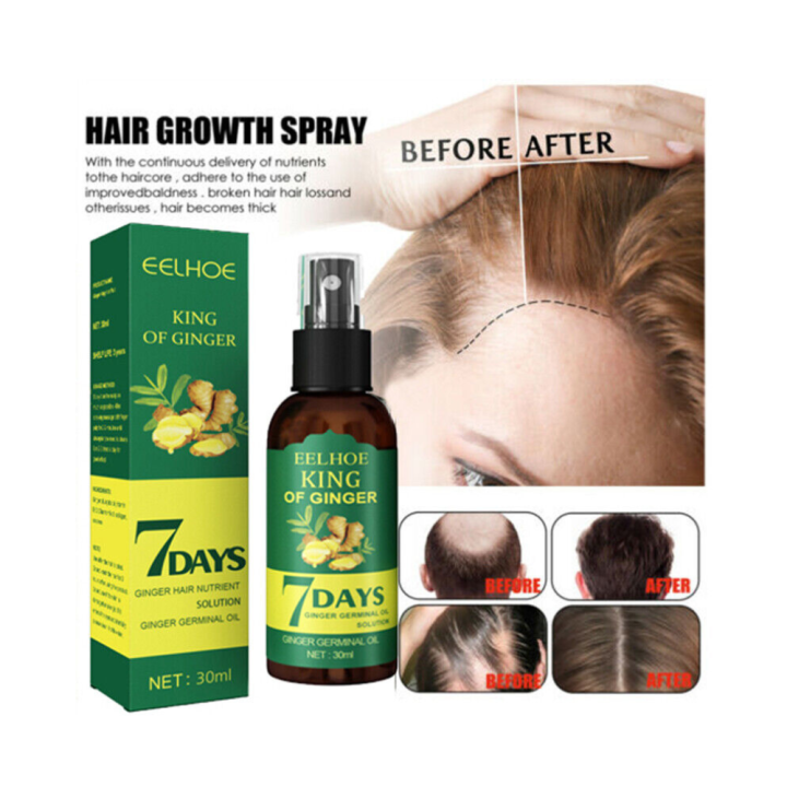 7Days%20Hair%20Growth%20Serum%20%E2%80%93%20Natural%20Germinal%20Serum%20Oil%20&%20Spray%20for%20Fast%20Hair%20Regrowth%20%7C%207Days%20Natural%20Hair%20Growth%20Serum%20with%20Herbal%20Formula%20for%20Men%20&%20Women%20%7C%20Anti%20Hair%20Fall%20Treatment%20&%20Thicker,%20Longer%20Hair%20%7C%20Original%207%20Days%20Hair%20Growth%20Spray.%20-%20Image%202