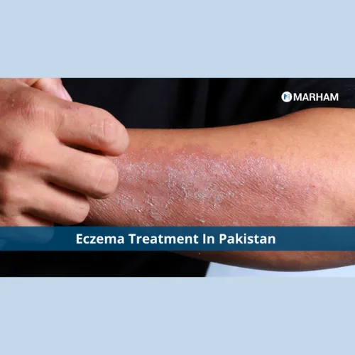 Eucerin%20Baby%20Eczema%20Relief%20Cream%20clinically%20proven%20to%20reduce%20incidence%20of%20eczema%20flare-ups%20Imported%20from%20U.S.A%20144g%20-%20Image%204