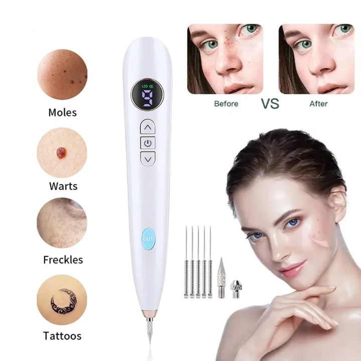 Profesional Laser Plasma Pen Skin Care Beauty Tool Black Dot Pore Skin Tag Blackhead Remover Warts Tattoo Removal Face Skin Care