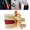 Lumbar Vertebrae Model Anatomical Spine Lumbar Disc Herniation Anatomy Teaching Tool Lumbar Vertebrae Model. 