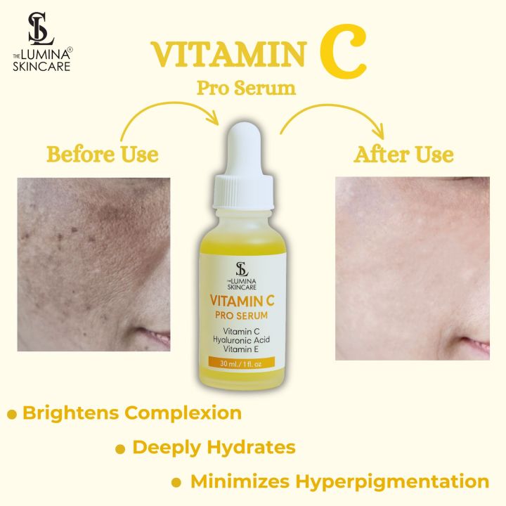 Vitamin%20C%20Serum%20with%20Hyaluronic%20Acid%20and%20Vitamin%20E,%20Triple%20Action%20Serum%20%7C%20Brightens%20&%20Hydrating%20the%20skin%20%7C%20The%20Lumina%20Skincare's%20Vitamin%20C%20Pro%20Serum%20%7C%2030ml%20-%20Image%203