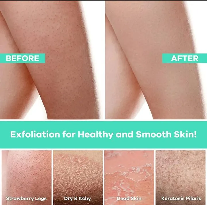 1pcs%20High%20Quality%20Exfoliating%20Gloves%20,%20Dead%20Skin%20Remover%20Sponge%20Deep%20Exfoliator%20for%20smoothing%20,%20Body%20scrubber%20for%20bathing%20and%20massage%20-%20Image%202