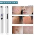 KINGDOMCARES Blue Light Therapy Acne Laser Pen Scar Wrinkle Removal Device white. 