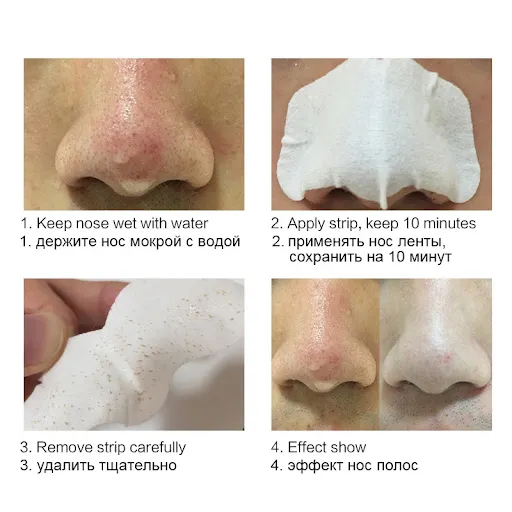 Pack%20of%206%20Deep%20Cleansing%20Nose%20Pore%20Strips%20for%20Blackhead%20Removal%20Random%20Brands%20-%20Image%202