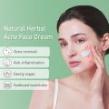JoyPrettyin Herbal Acne Treatment Face Cream Pimple Scar Remove Oil Control Moisturizing Facial Skin Care Cream Cosmetic Beauty. 