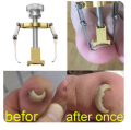 Professional Ingrown Toe Nail Correction Pedicure Toes Treatment Tool for Paronychia, Ingrown Nail Corrector Toenail Foot Nail Care,Eliminate Pain & Remover Orthotic Appliance, Stainless Steel Toes Treatment Manicure Pedicure Tool. 