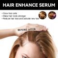 30Ml Hair Growth Essential Oil Pure Natural Nourish Repair Damaged Dry and Frizz Hair Rosemary Anti Hair Loss Serum Oil. 
