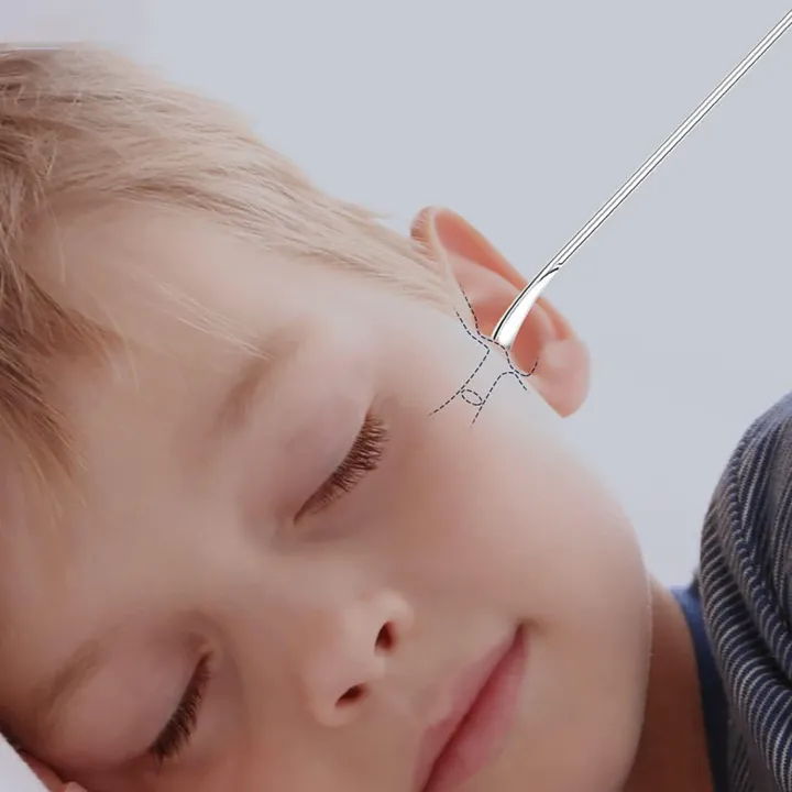 Ear%20Cleaner%20Earwax%20Removal%20Kit:%20Ear%20Wax%20Removal%20-%20Ear%20Cleaner%20with%206%20Pcs%20Ear%20Set%20-%20Earwax%20Remover%20Tool%20-%20Ear%20Cleaning%20Kit%20for%20Adults%20with%20Storage%20Bag%20(Yellow)%20-%20Image%207