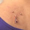 12Pcs Copper Skin Tag Remover Clips Wart Tag Extractor Copper Tag Out. 