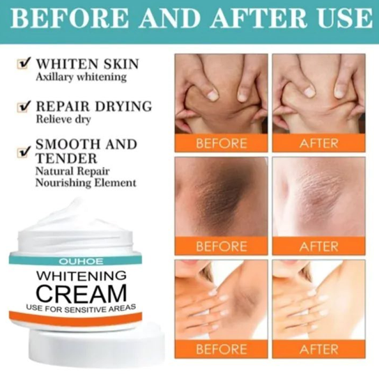 Urban Gland Underarm Cream Emulsion Cream For Women Skin Underarm Cream Dark Spot Cream For Underarm Neck Armpit Knees Elbows Intimate