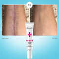 RtopR Scar Removal Cream Acne Scar Treatment Face Face Cream Repair Skin Care Stretch Burn Scar Remover Skin Repair Spots Body Skin Cream 15g. 