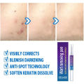 Skin Tag eye Wart Mole Remover Pen Woman Skin Care Removing Against Moles Pimple Patch Remove Black Dot FLAIREX. 