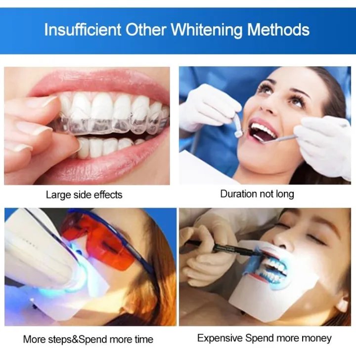 Advanced%20Teeth%20Whitening%20Strips%20%E2%80%93%20Dental%20Bleaching%20Tools%20for%20Oral%20Hygiene%20Care,%20Effectively%20Brighten%20and%20Whiten%20Your%20Teeth%20-%20Image%203