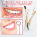 Jaysuing Fruit Toothpaste Fight Bleeding Gums Fresh Breath Stain Removal Whitening Pressing Toothpaste Teeth Oral Health Care. 