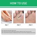 New 10ml Foot Corn Eence Effective Feet Callue Wart Remover Foot Wart Cream - 287991028. 