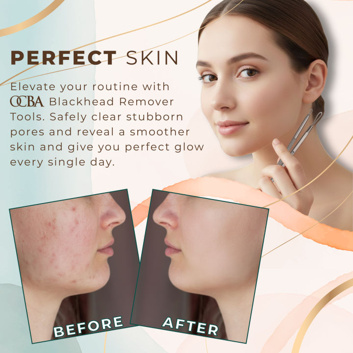 OCBA%20Blackhead%20Remover%20Tool%20Set%20Double%20Ended%20Loop%20Extractor,%20Anti%20Slip%20Grip,%20Stainless%20Steel%20Pimple%20&%20Acne%20Removal%20Kit%20for%20Men%20&%20Women%20-%20Image%207