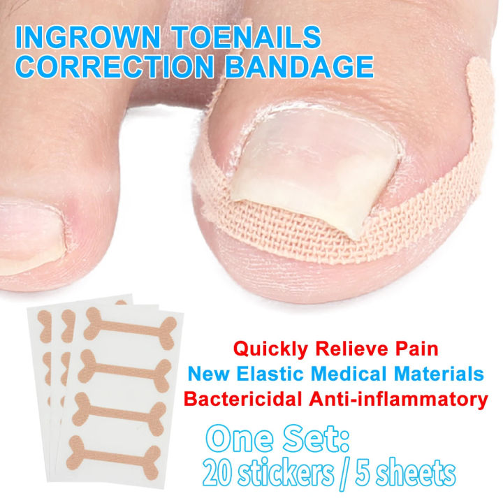 20pcs ingrown toenails band Aid relief pain Paronychia correction pedicure Elastic Force Sticker Repair bandage toe nail care